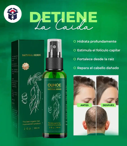 OUHOE® NATURAL 2x1 || Spray para el crecimiento del cabello